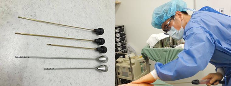 脂肪吸引 痩身 部分痩せの整形 施術一覧 名古屋院 美容整形 美容外科なら水の森美容外科 公式