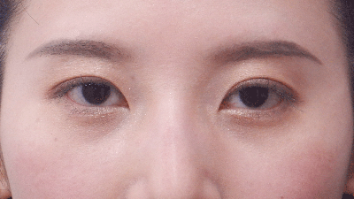 術後10